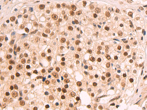 Rabbit Polyclonal Antibody to ZNF138