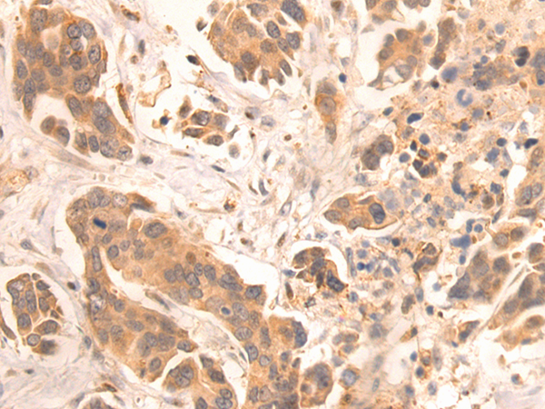 Rabbit Polyclonal Antibody to ZKSCAN3
