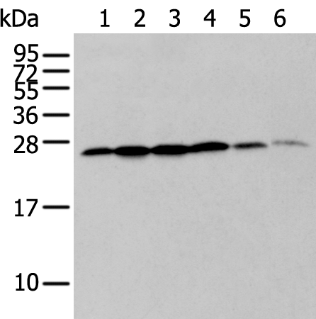 Rabbit Polyclonal Antibody to ZMAT2