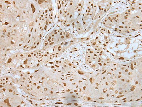 Rabbit Polyclonal Antibody to ZNF19