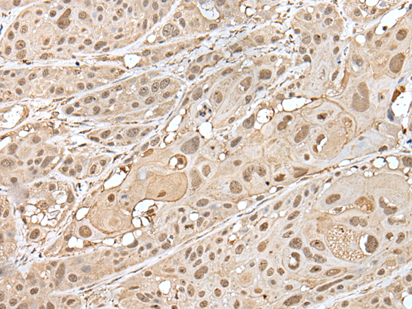 Rabbit Polyclonal Antibody to ZNF202