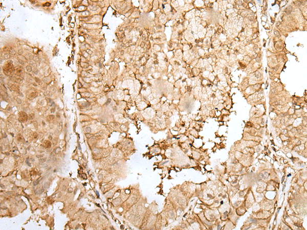 Rabbit Polyclonal Antibody to ZNF213