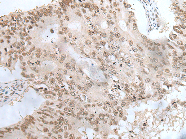 Rabbit Polyclonal Antibody to ZNF24