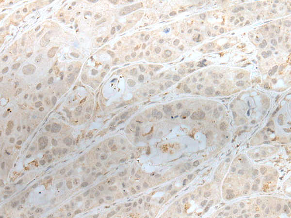 Rabbit Polyclonal Antibody to ZBTB18