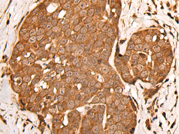 Rabbit Polyclonal Antibody to ZPR1