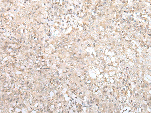 Rabbit Polyclonal Antibody to ZNF263