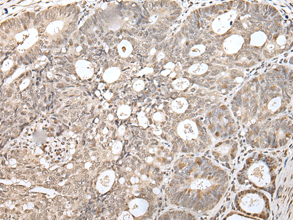 Rabbit Polyclonal Antibody to ZNF266