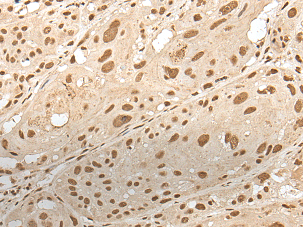 Rabbit Polyclonal Antibody to ZNF274