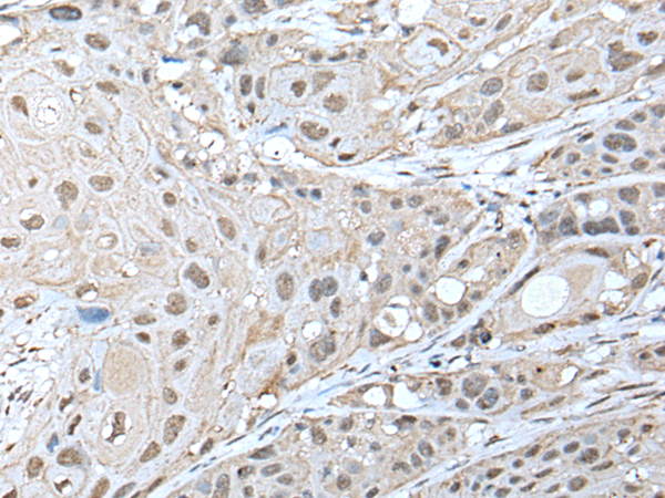 Rabbit Polyclonal Antibody to ZNF277