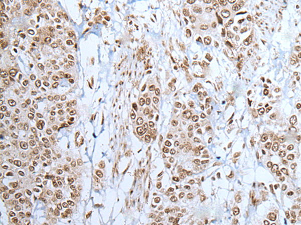 Rabbit Polyclonal Antibody to ZNF302
