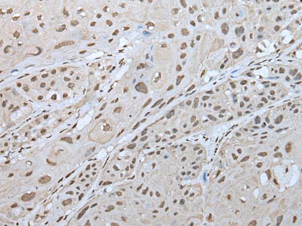 Rabbit Polyclonal Antibody to ZNF300