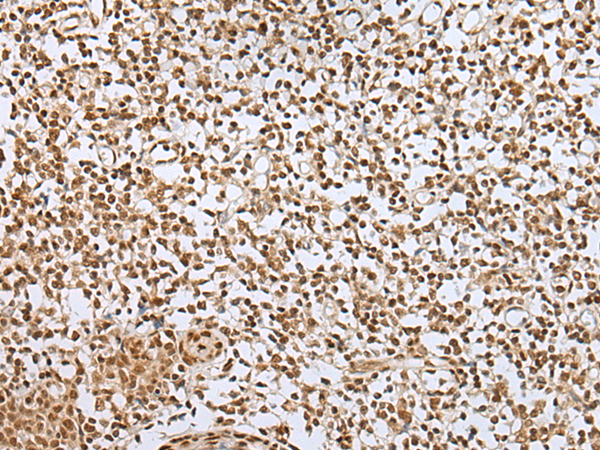 Rabbit Polyclonal Antibody to ZNF354A