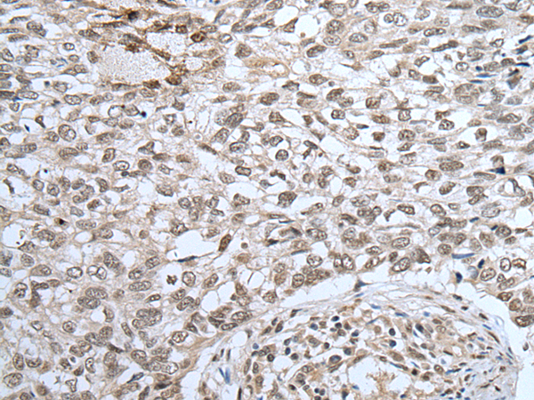 Rabbit Polyclonal Antibody to ZNF37A