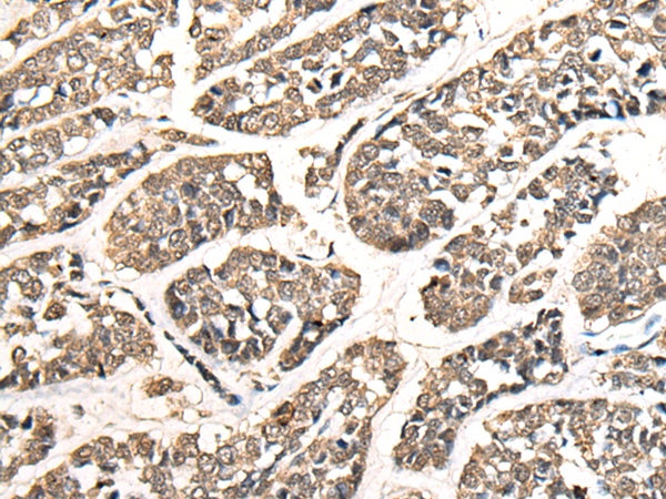 Rabbit Polyclonal Antibody to ZNF41