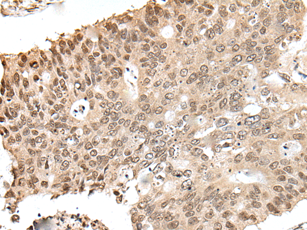 Rabbit Polyclonal Antibody to ZNF410