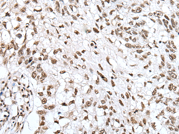 Rabbit Polyclonal Antibody to ZNF43