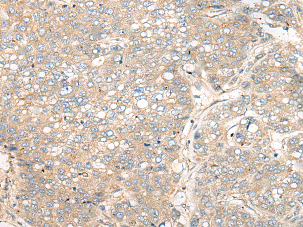 Rabbit Polyclonal Antibody to ZNF449