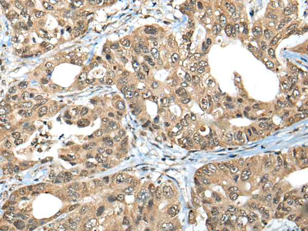 Rabbit Polyclonal Antibody to ZNF468