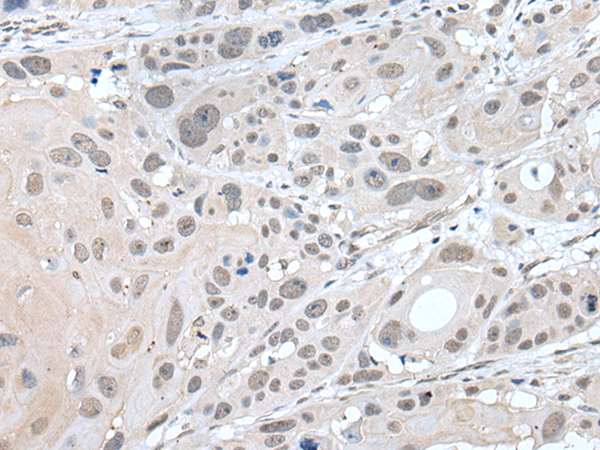 Rabbit Polyclonal Antibody to ZNF483