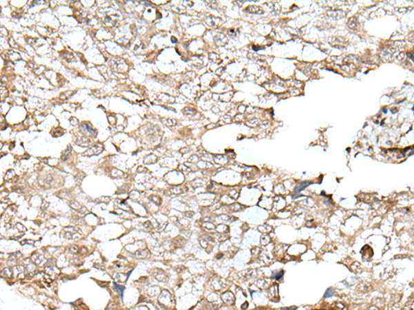 Rabbit Polyclonal Antibody to ZNF496