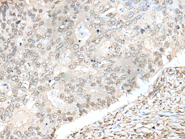 Rabbit Polyclonal Antibody to ZNF512