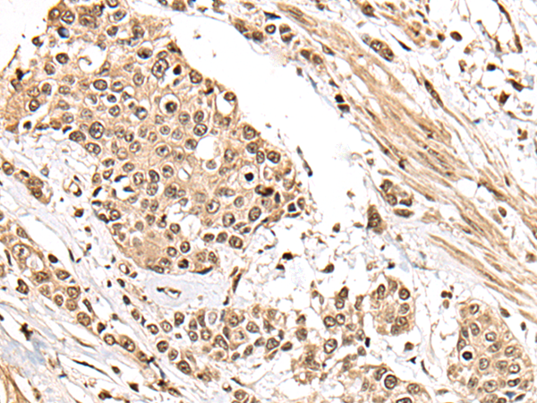 Rabbit Polyclonal Antibody to ZSCAN29