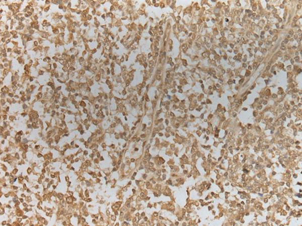 Rabbit Polyclonal Antibody to ZNF8