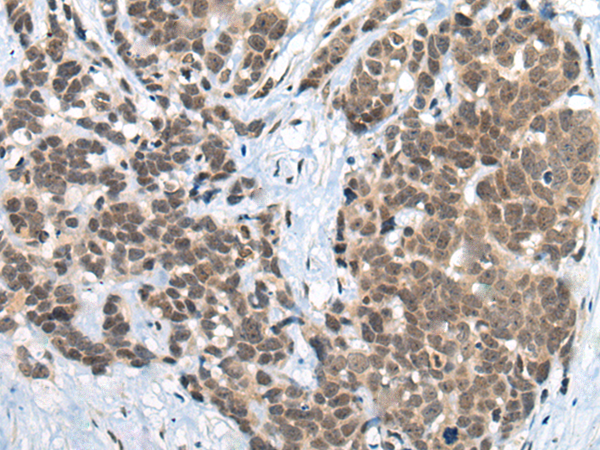 Rabbit Polyclonal Antibody to ZNF83