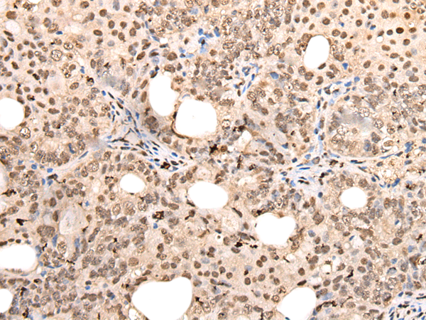 Rabbit Polyclonal Antibody to ZSCAN12