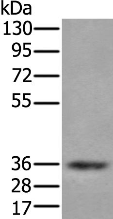 Rabbit Polyclonal Antibody to ZPBP