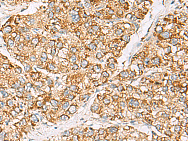 Rabbit Polyclonal Antibody to ZPBP2