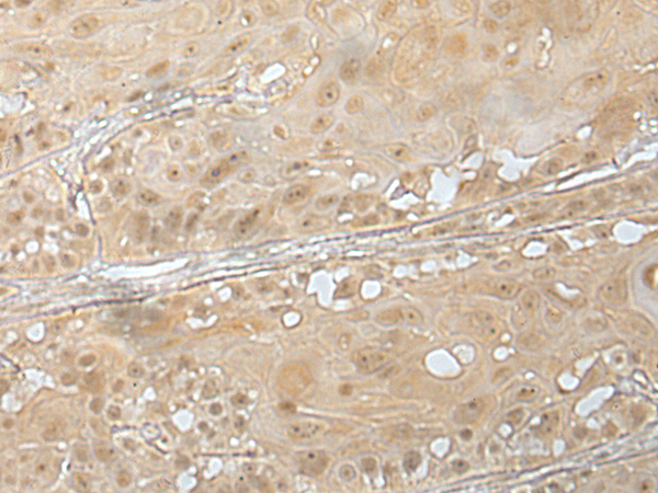 Rabbit Polyclonal Antibody to ZUP1