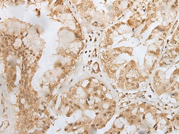 Rabbit Polyclonal Antibody to ZYX