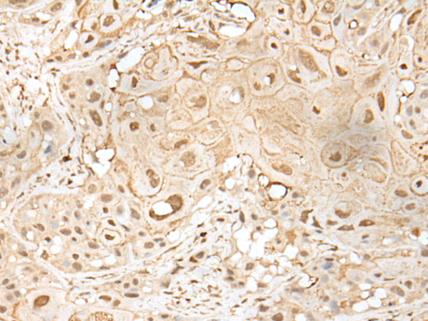 Rabbit Polyclonal Antibody to ZZZ3