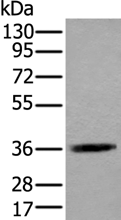 Rabbit Polyclonal Antibody to ACAT2