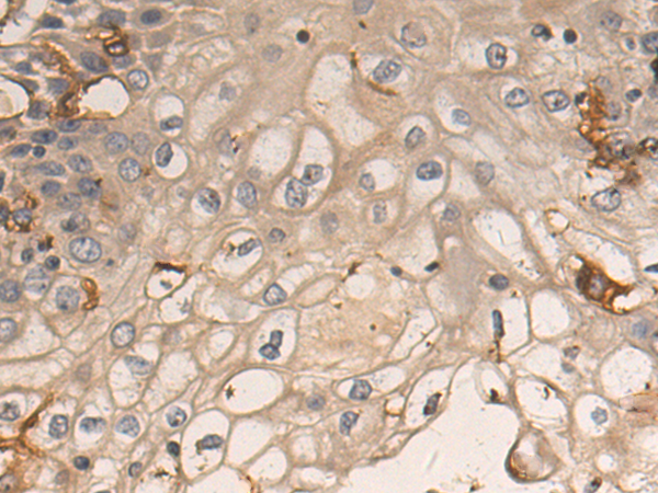 Rabbit Polyclonal Antibody to CD14