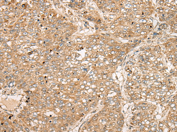 Rabbit Polyclonal Antibody to TDGF1