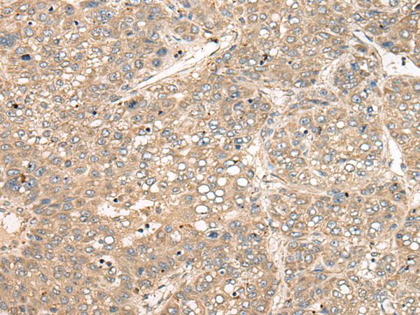 Rabbit Polyclonal Antibody to CD55