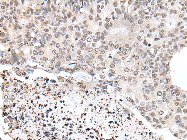 Rabbit Polyclonal Antibody to YPEL1