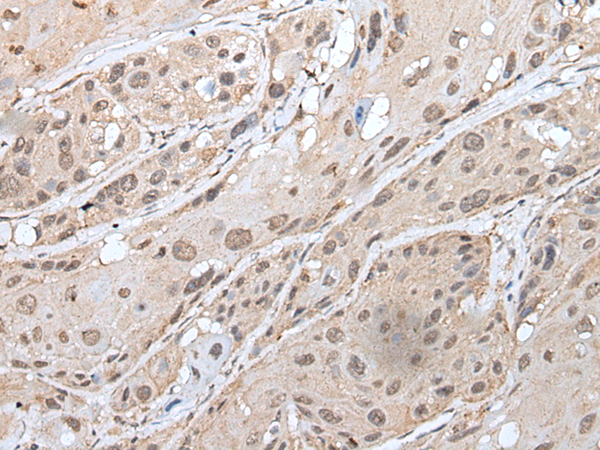 Rabbit Polyclonal Antibody to YPEL3