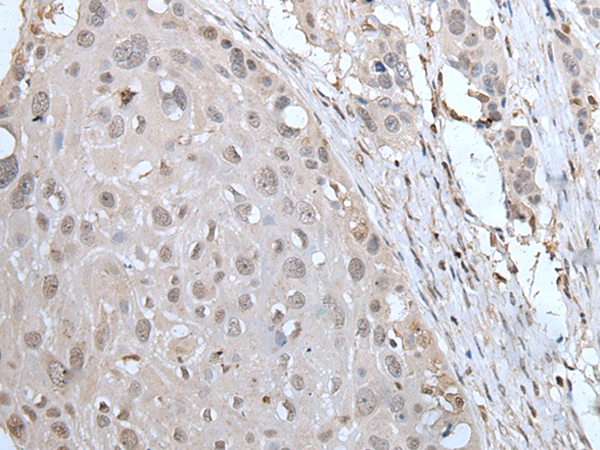 Rabbit Polyclonal Antibody to YPEL2