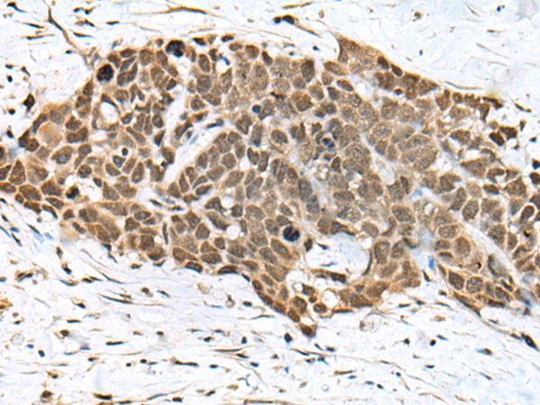 Rabbit Polyclonal Antibody to XPO6