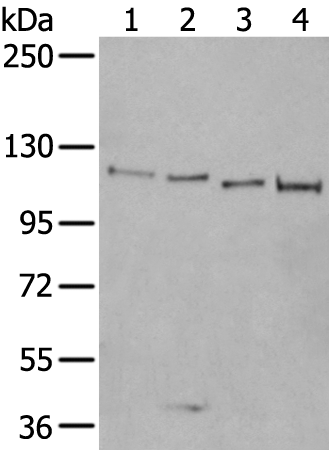 Rabbit Polyclonal Antibody to XRN2