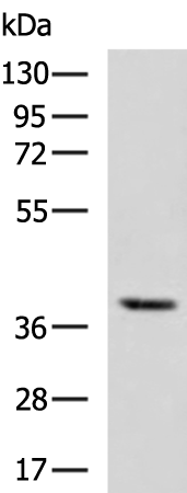 Rabbit Polyclonal Antibody to WARS2