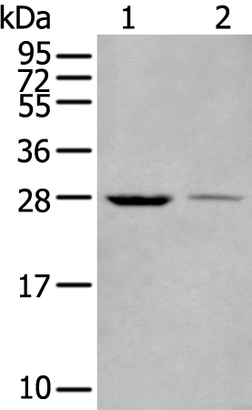 Rabbit Polyclonal Antibody to WBP1