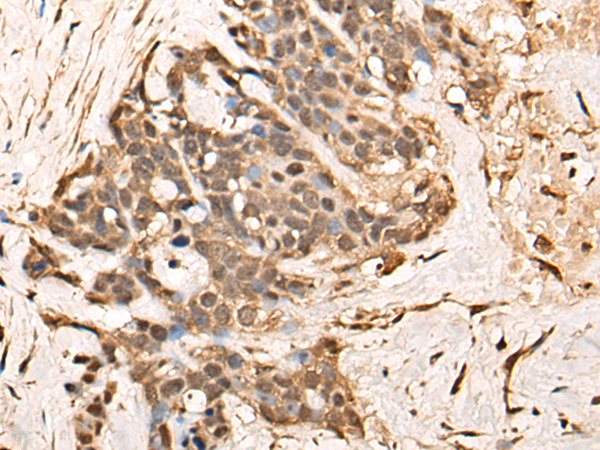 Rabbit Polyclonal Antibody to TCEAL9