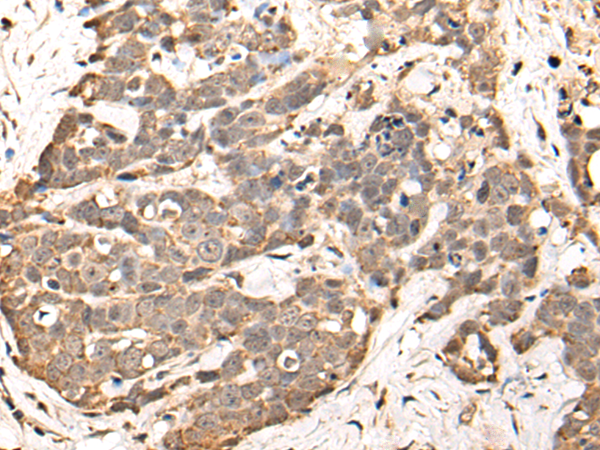 Rabbit Polyclonal Antibody to WDFY3