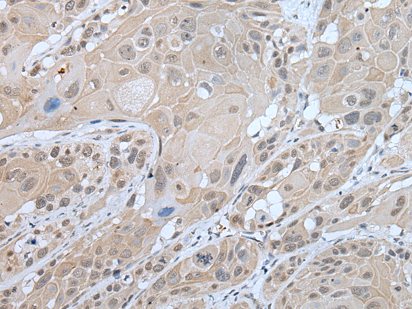 Rabbit Polyclonal Antibody to WFS1