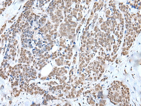 Rabbit Polyclonal Antibody to WTAP