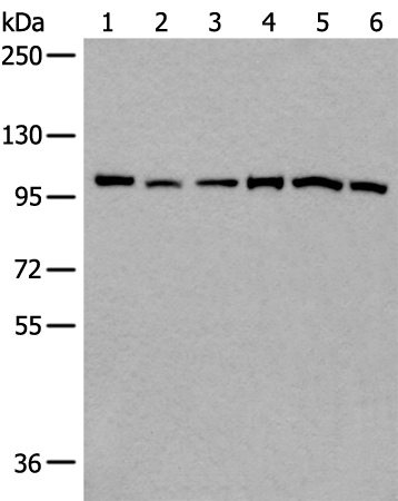 Rabbit Polyclonal Antibody to VCP